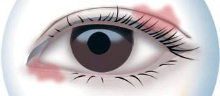 CBA***得分手發(fā)高燒吸氧0得分 教練：賓館房間新裝修，甲醛中毒導(dǎo)致的！