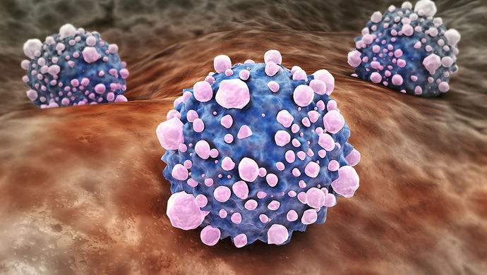 平時(shí)不注意甲醛超標(biāo)，50歲女子劇烈頭痛、惡心干嘔，一查已是癌癥晚期！
