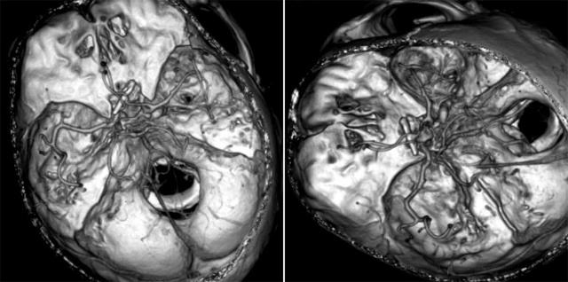 平時(shí)不注意甲醛超標(biāo)，50歲女子劇烈頭痛、惡心干嘔，一查已是癌癥晚期！