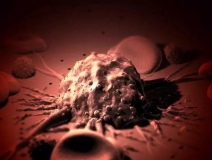 癌癥、白血病越來越多，是因為時代在進步而導致的嗎？