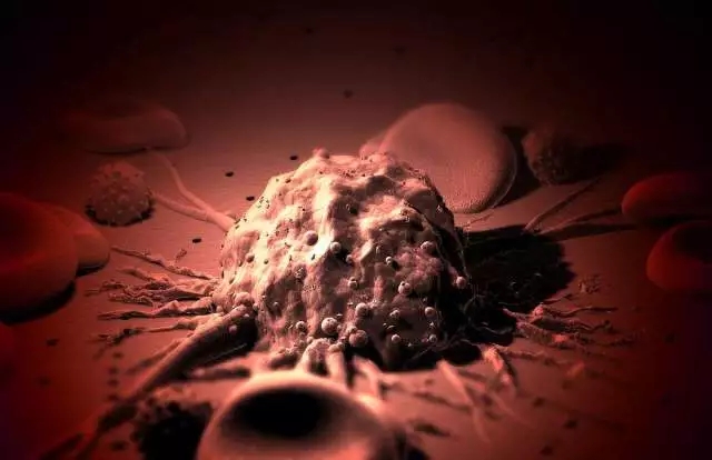 癌癥、白血病越來越多，是因?yàn)闀r(shí)代在進(jìn)步而導(dǎo)致的嗎？